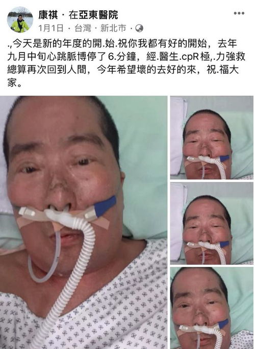 茍偉死因曝光 鼻息肉肥大致呼吸驟停