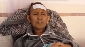 丈夫抽煙43年妻子確診肺癌晚期